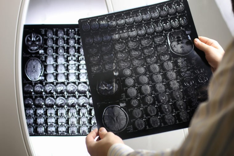 Doctor holding a picture of a brain MRI workflow in diagnostic hospital