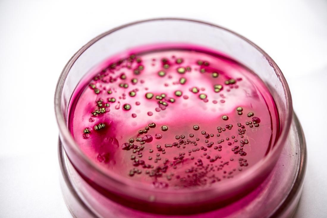 bacterial culture in petri dish concept photo